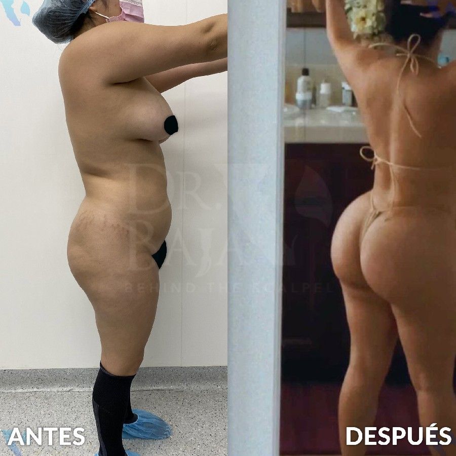 Renato Rodríguez Hirales-35