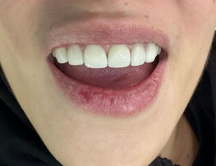 Martha Grissel Alcantar Camacho-3