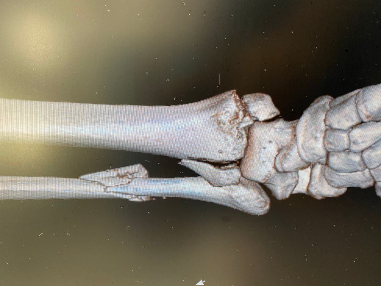 Alberto Lorenzo Cortés-19