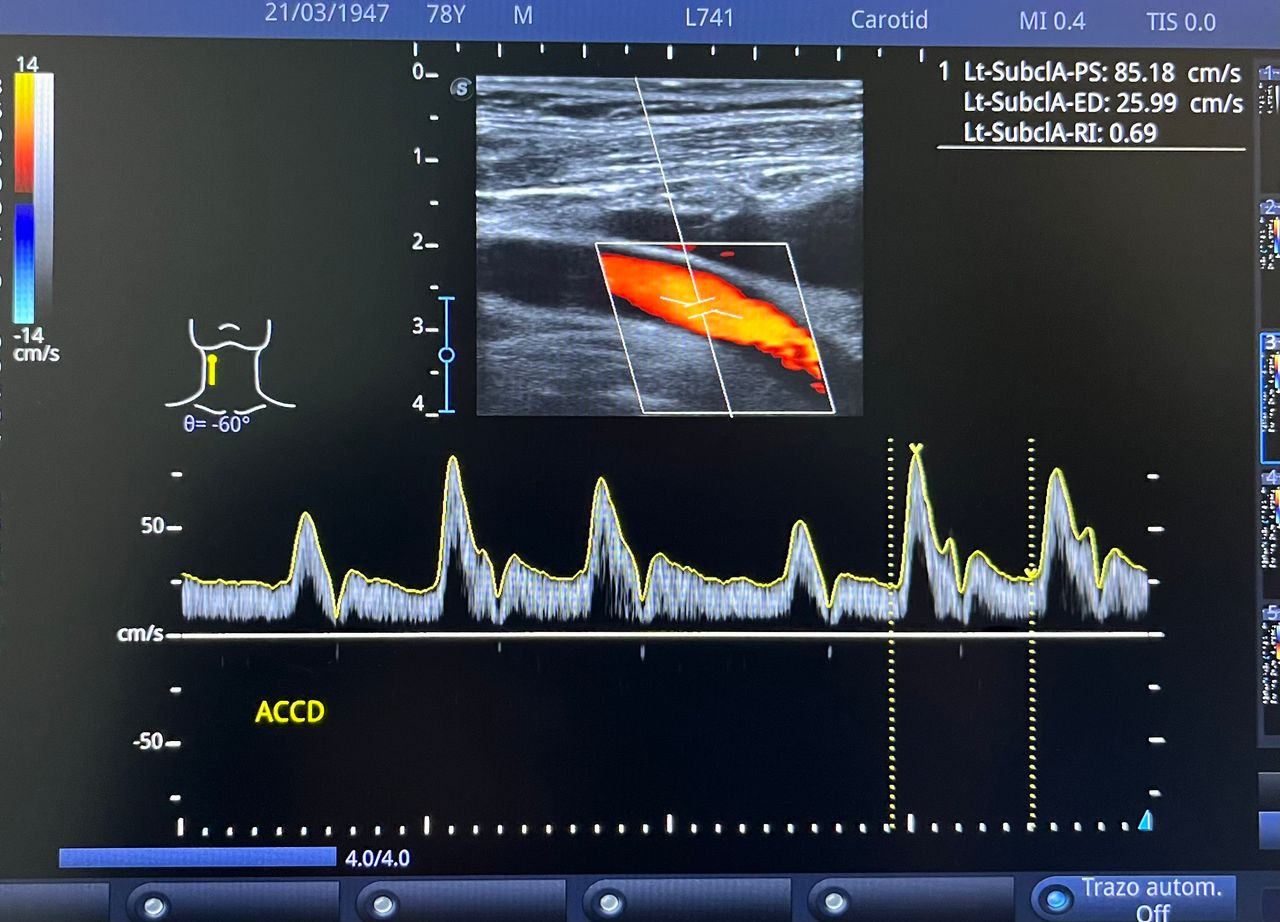 César Guerra Martínez-53