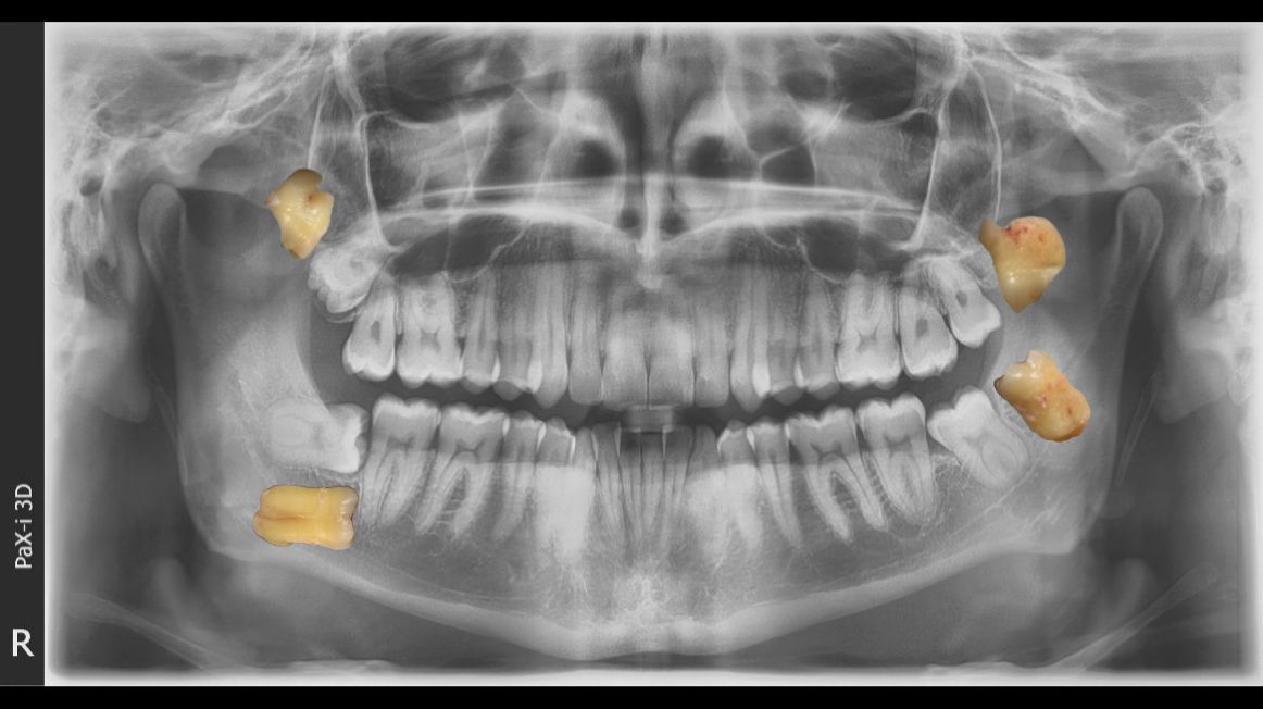 Luis Angel Carranza Resendez-13