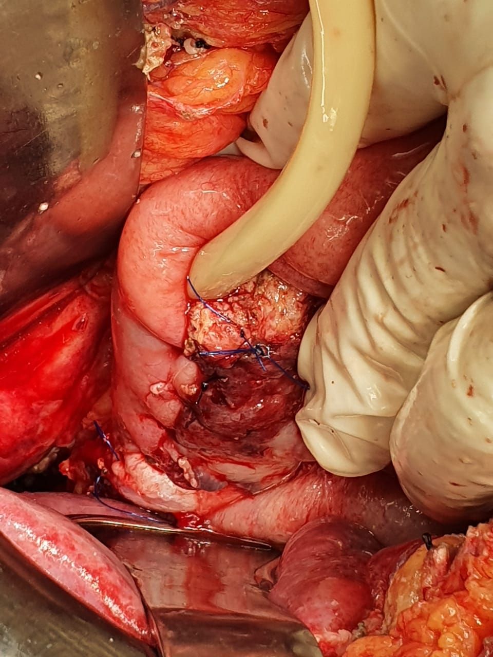 Mateo Ponciano Guerrero-29