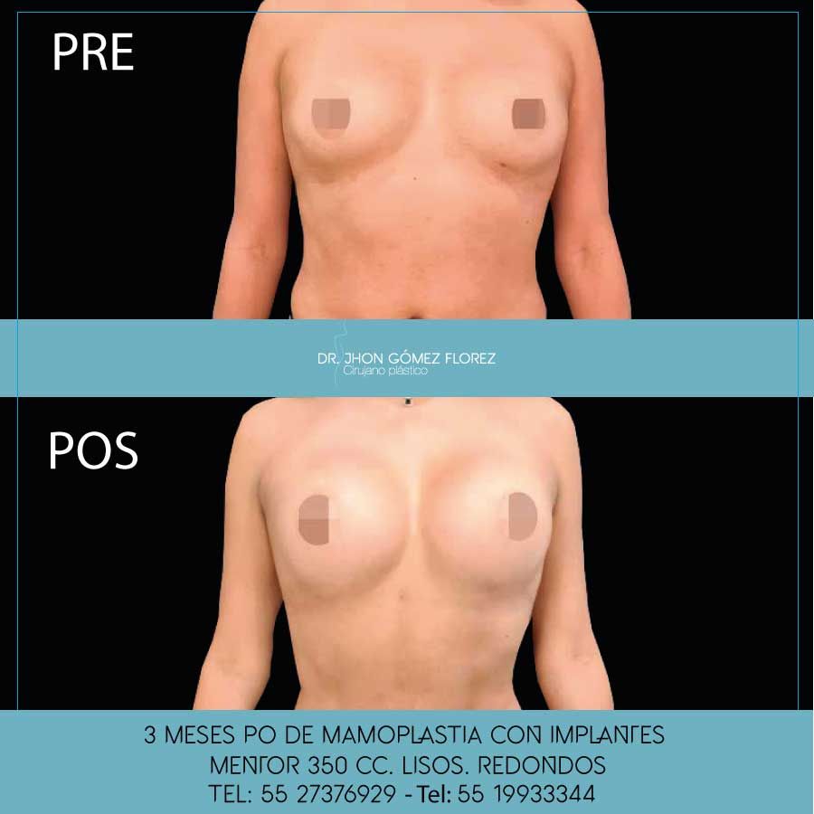 Jhon César Gómez Florez-8