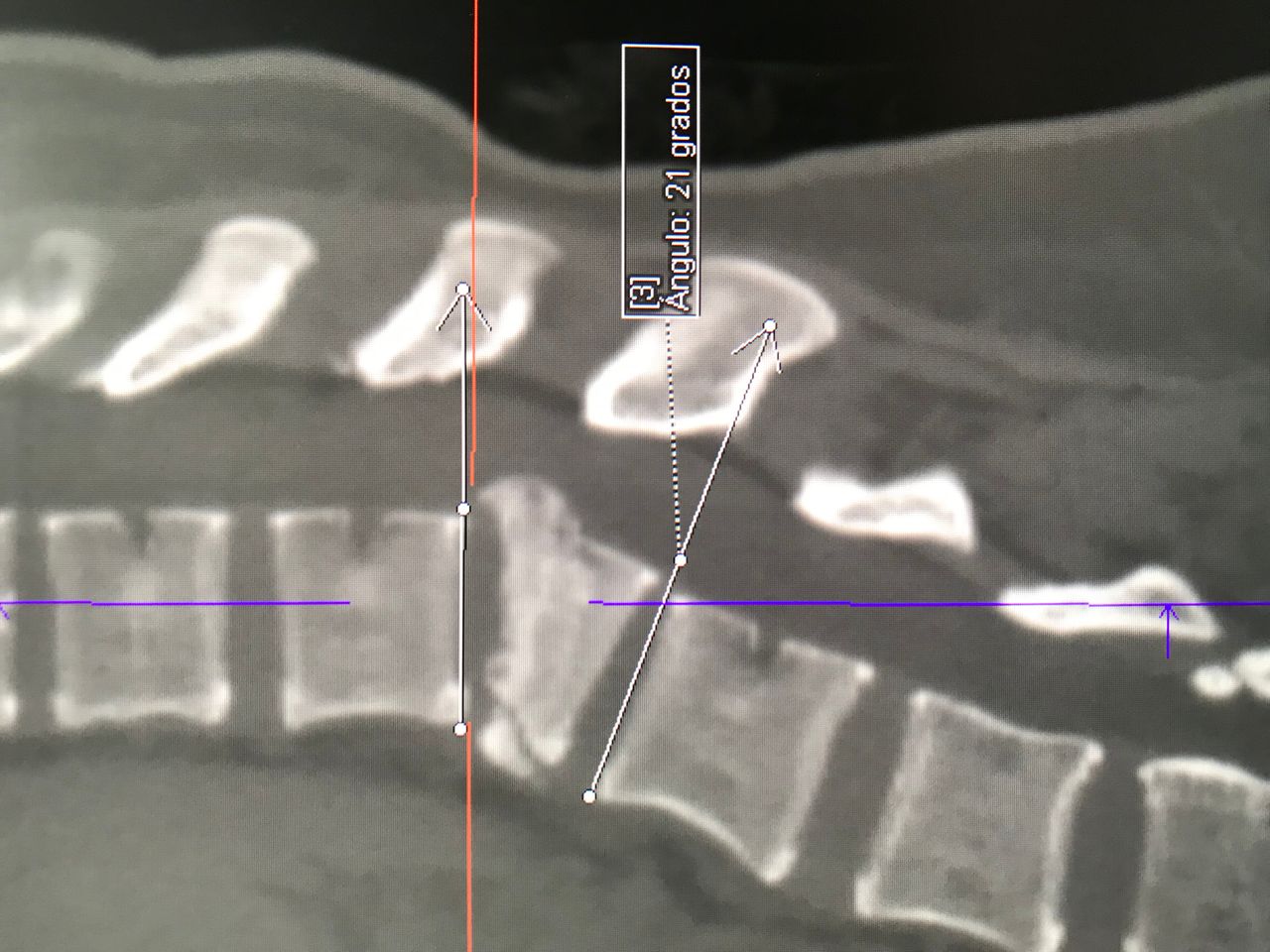 Rafael Maciel Morfin-30