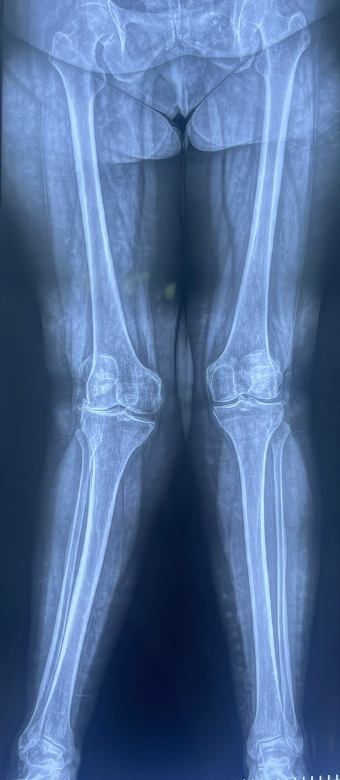 Alejandro Álvarez Colín-0