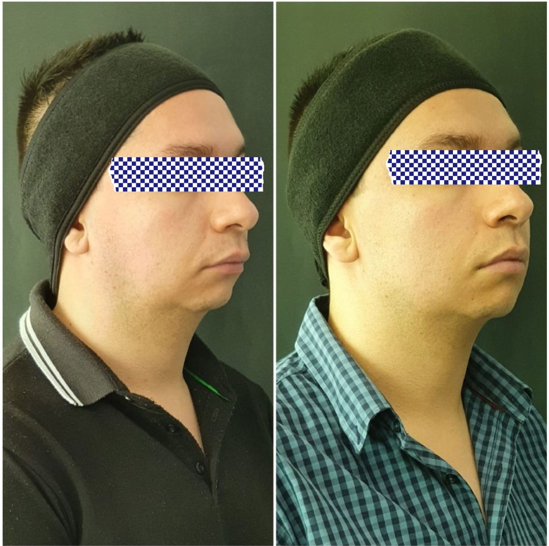 Edgar Gómez García-16