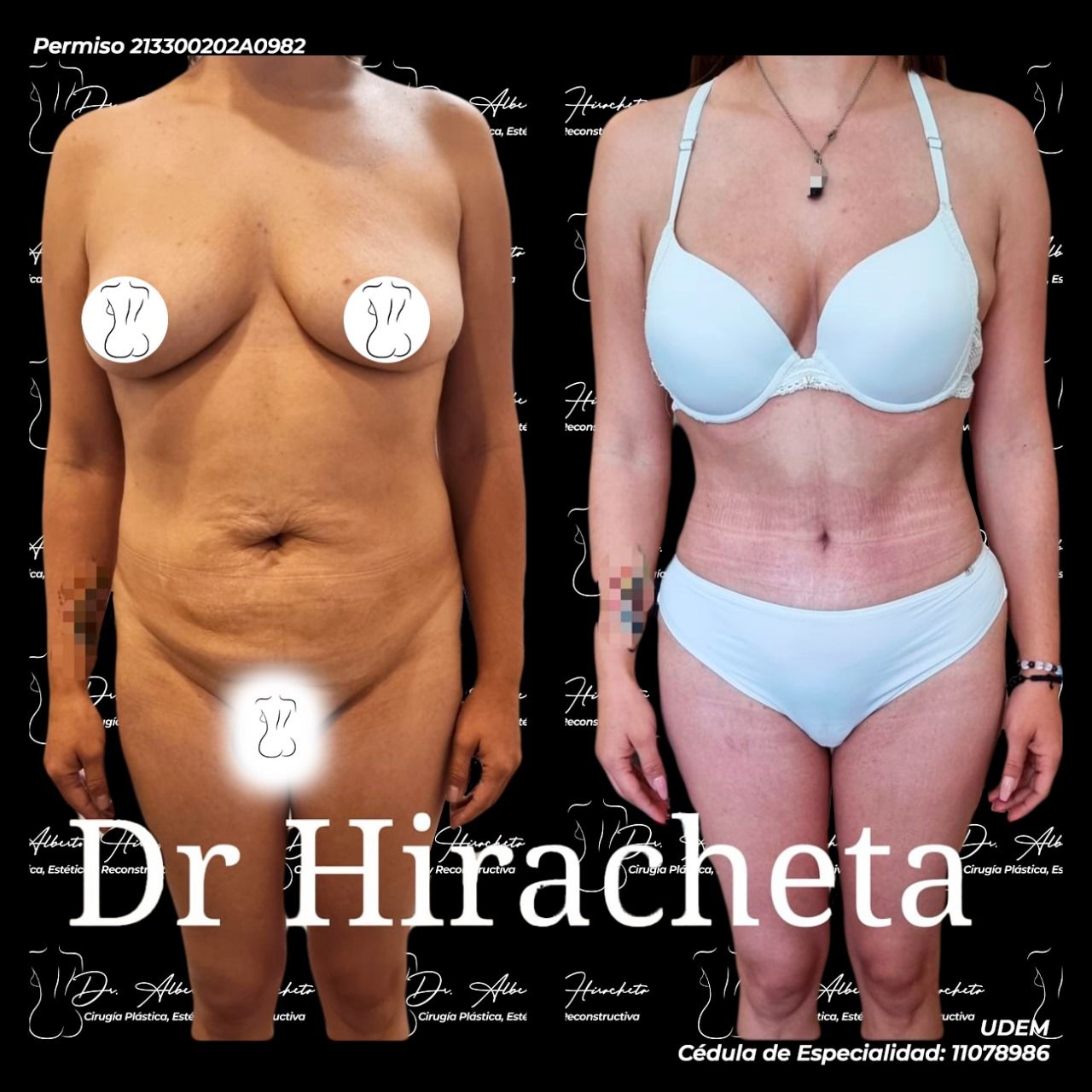 Alberto Hiracheta Torres-13