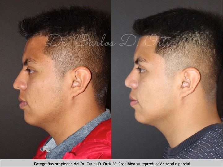 Carlos David Ortiz Moreno-9