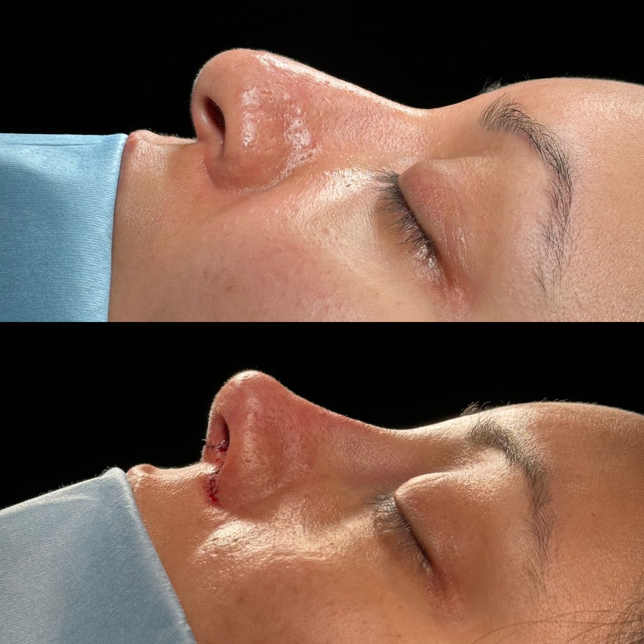 Angel Castro Urquizo-142