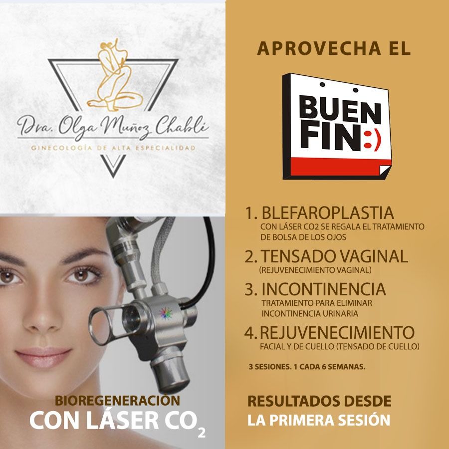 Olga Alejandra Muñoz Chablé-0