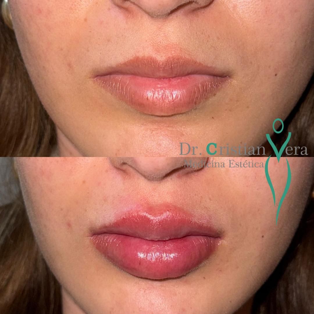 Cristian Eduardo Vera Nuño-21