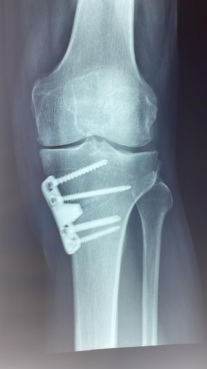 Roberto Wences Álvarez-3