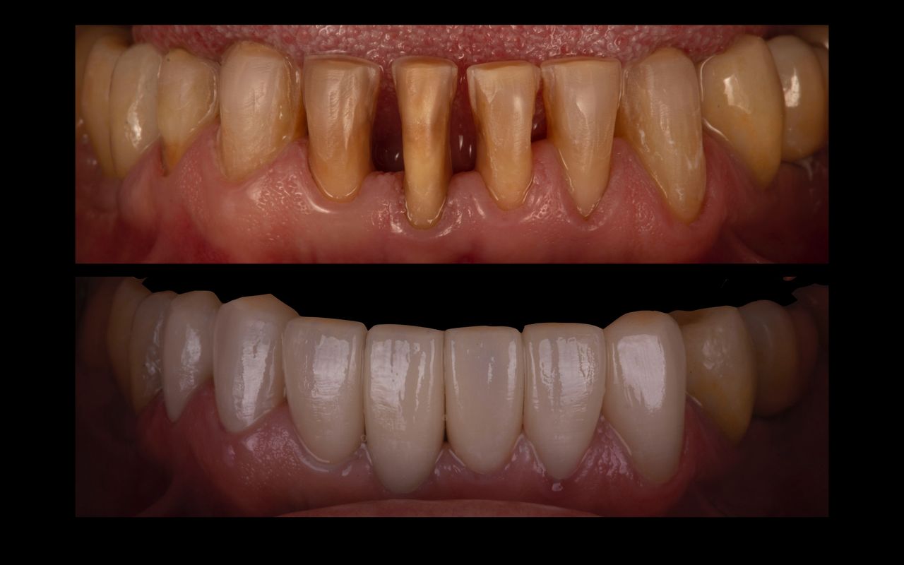 María Fernanda González Gastelum-59