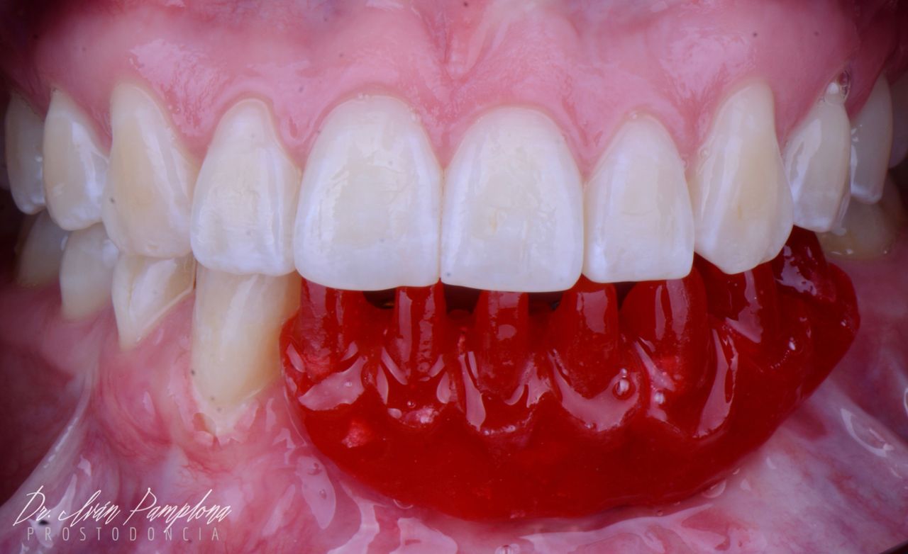 Iván Gerardo Pamplona Alfaro-25