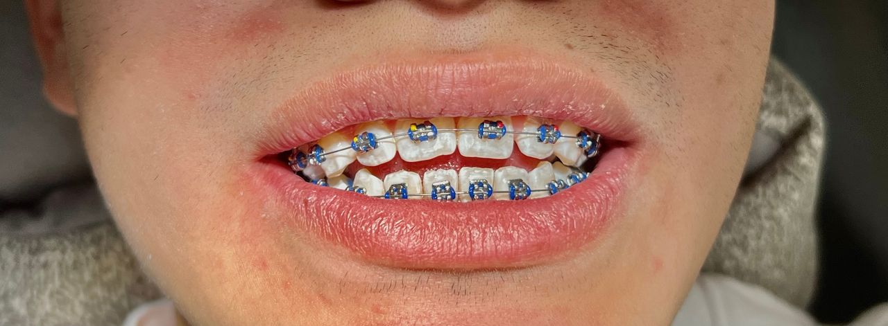 Valeria Muñoz Balboa-10