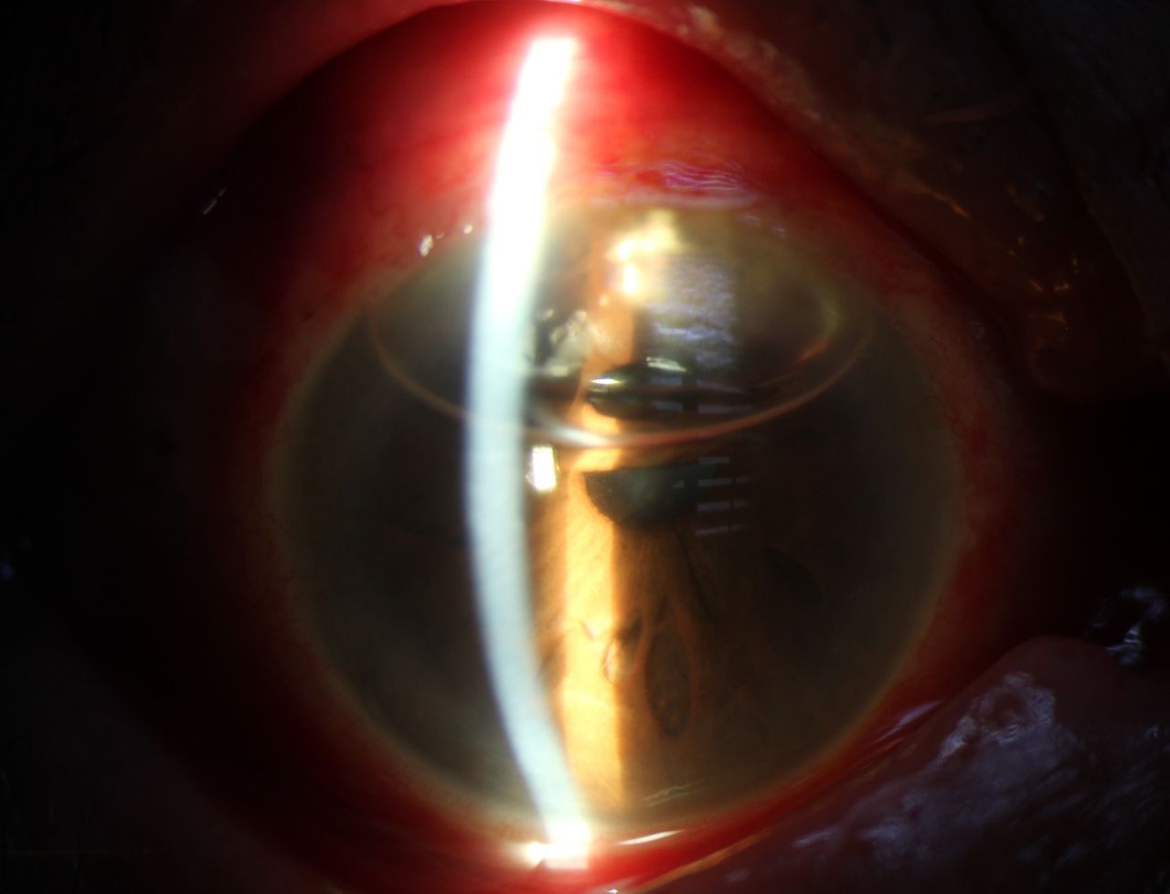 Kalid Barush Hernández Diaz-10