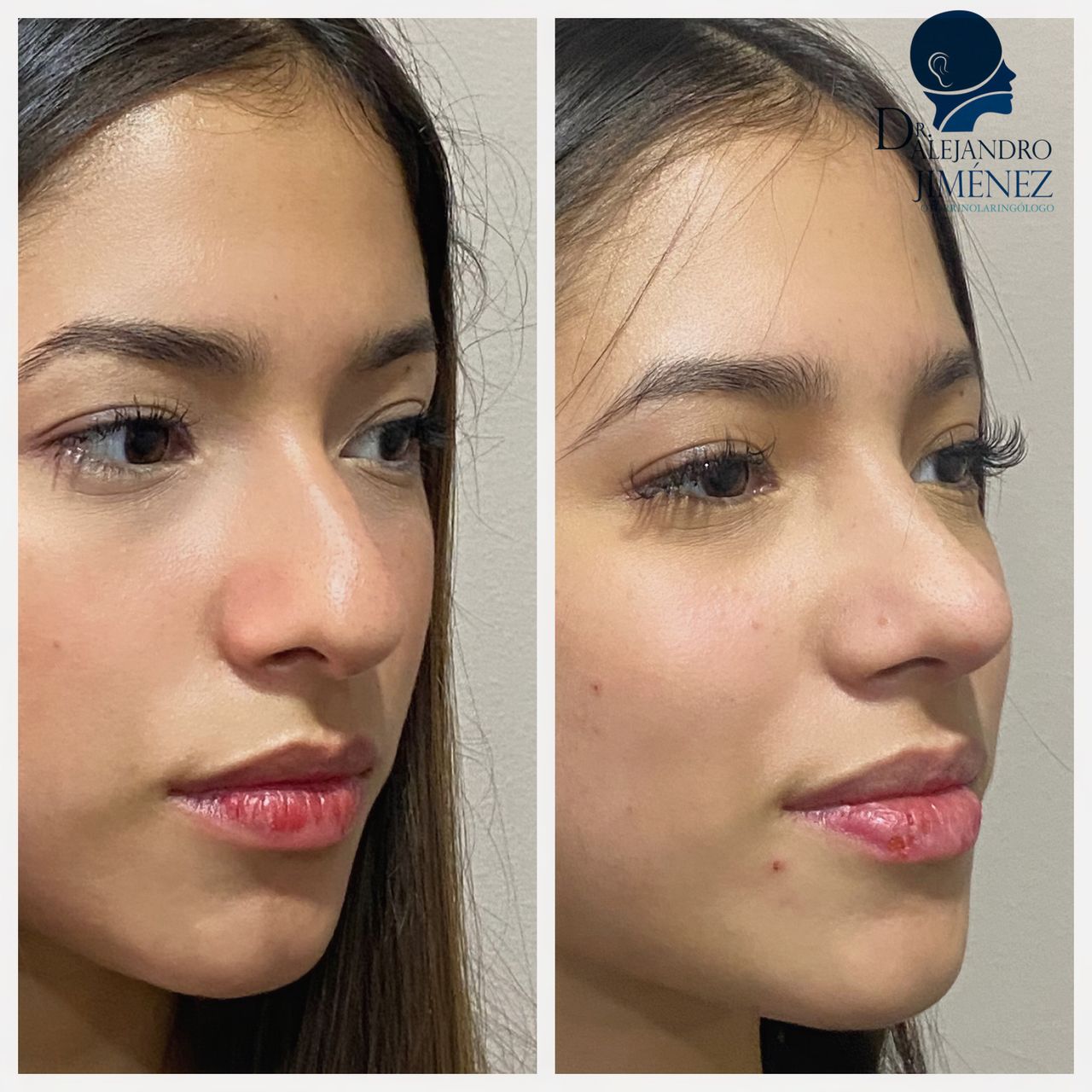 Alejandro Jimenez Garcia-53