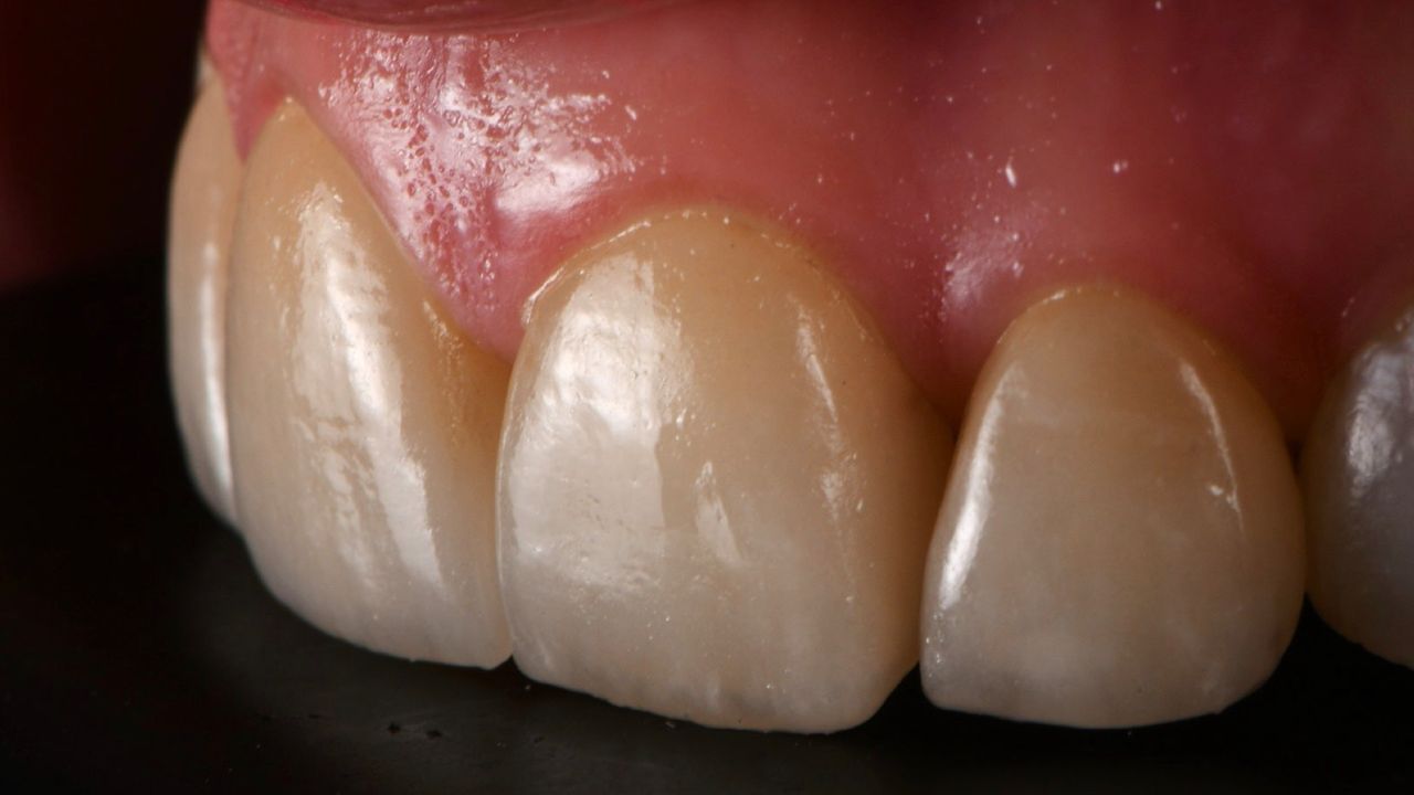 Ricardo López Lemus-83