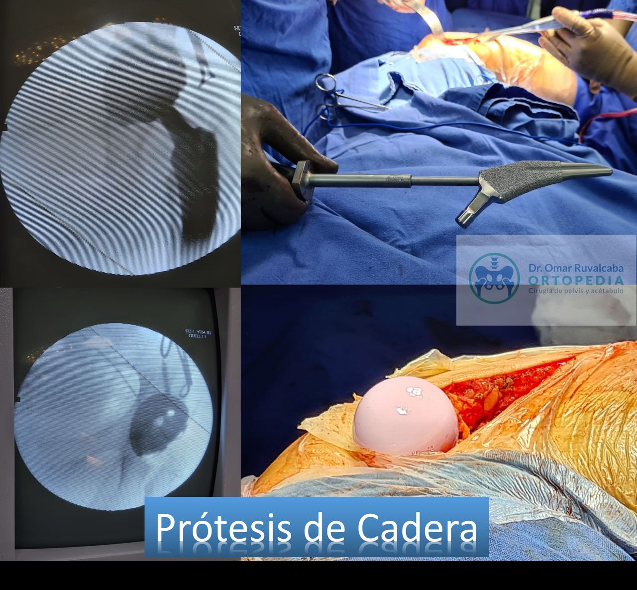 Omar Ruvalcaba Luna-21