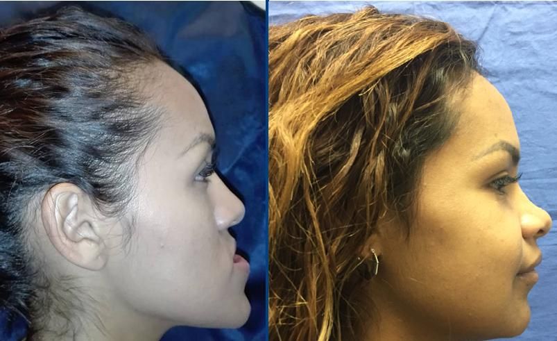 Alberto Wintergerst Fisch-36