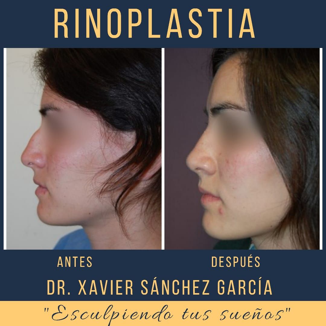 Xavier Sánchez García-44