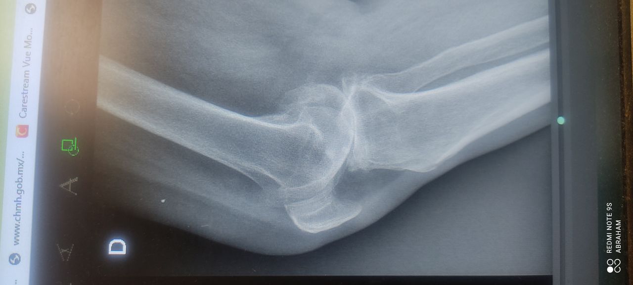 Abraham Israel Tachiquín Ruiz-6