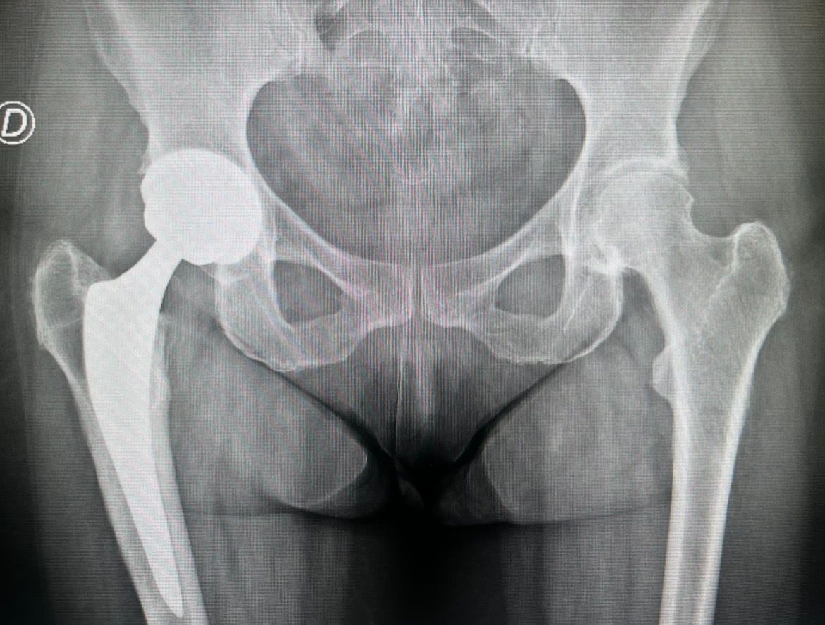 Ozmar Ignacio Ochoa Villar-0