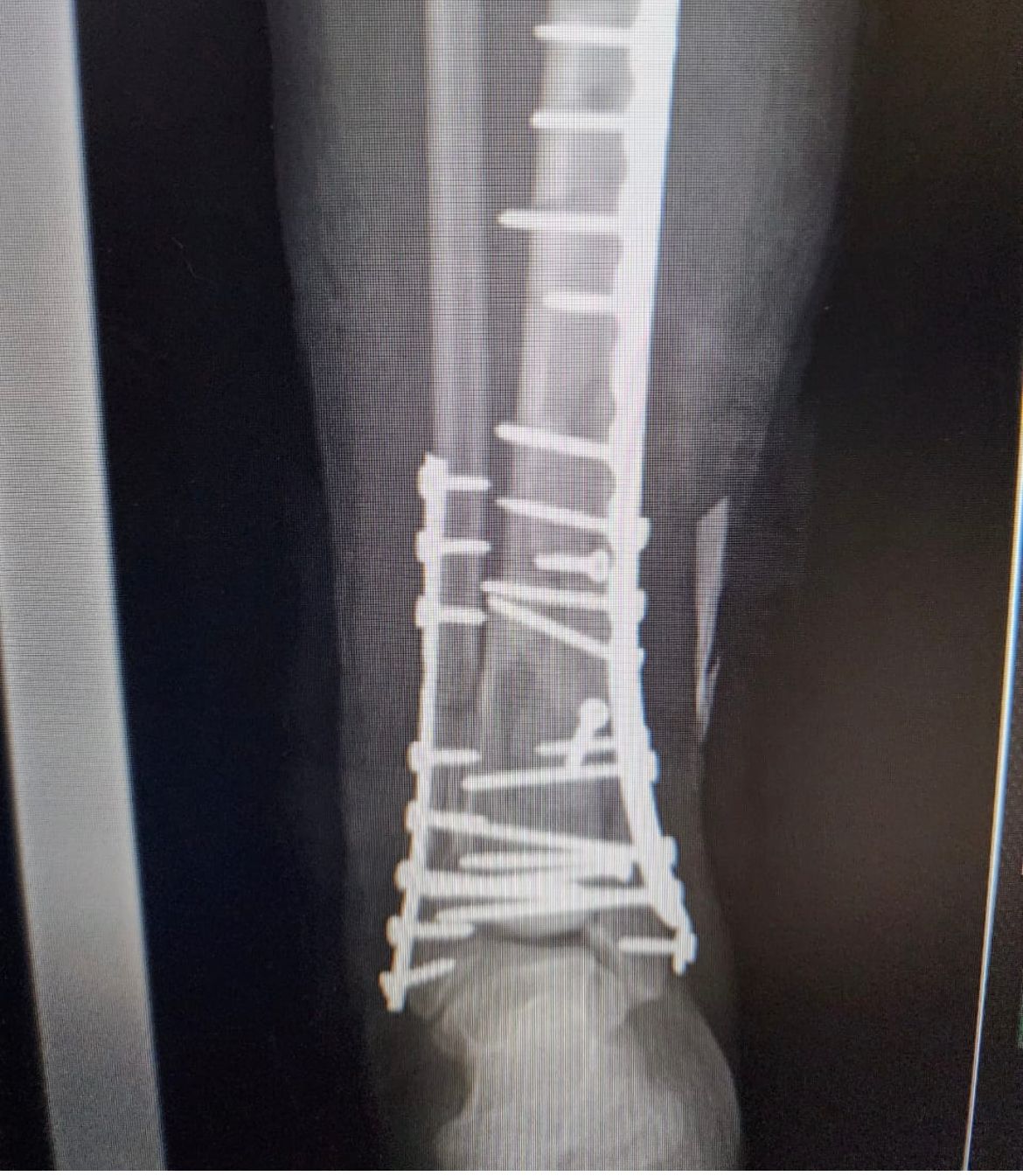 Emmanuel Bolaños Cortes-9