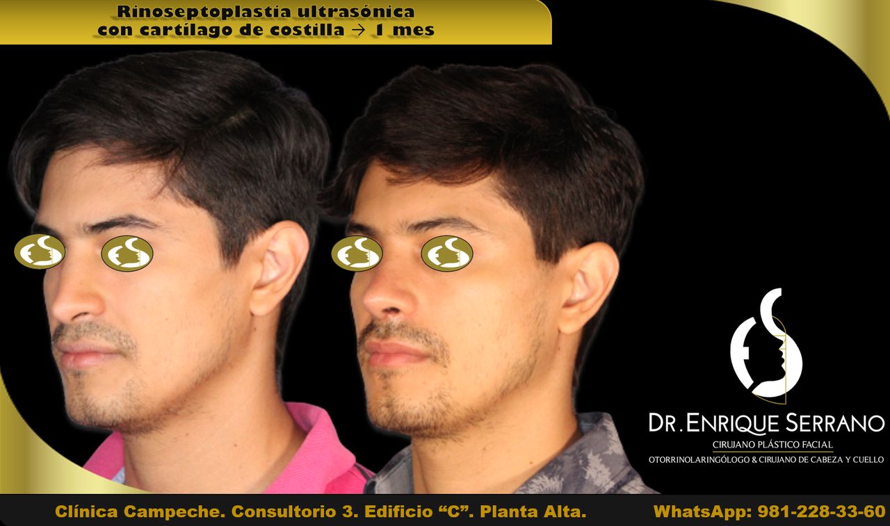 Enrique Serrano Cruz-15