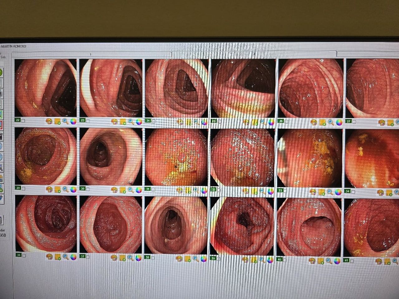 Humberto Servando Camiro Arango-17