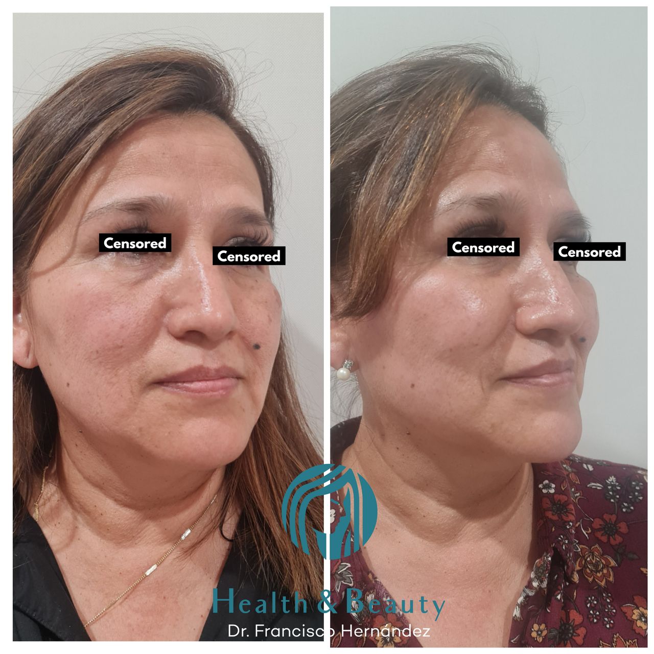 Francisco Hernández Gómez Crespo-109