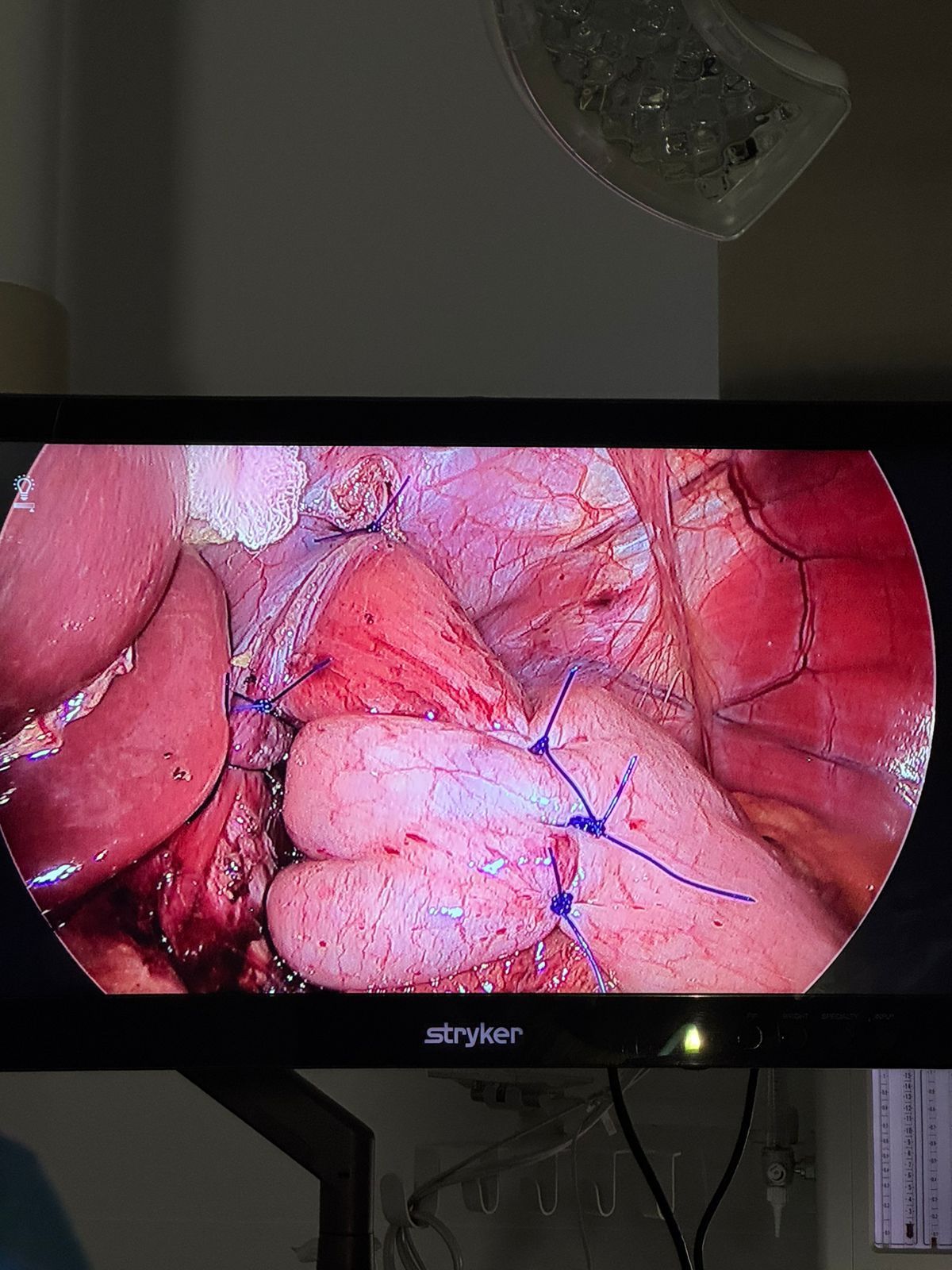 Aarón Torres Vázquez-3