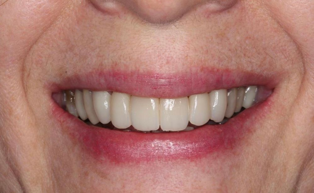 Jesus De La Cruz Ballinas-18