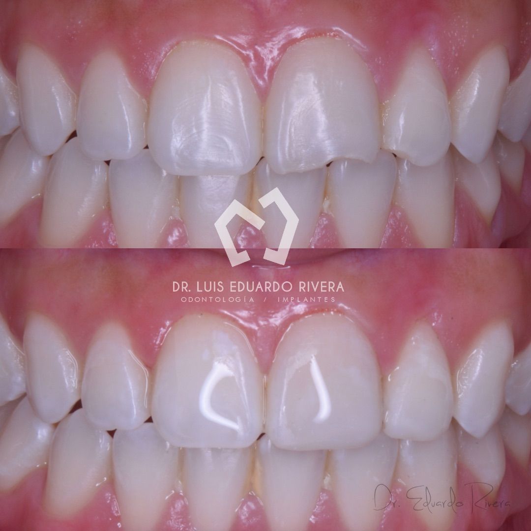 Luis Eduardo Rivera-49