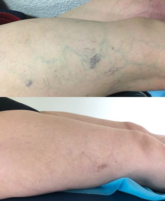 Rebeca Margarita Herrera Llamas-6