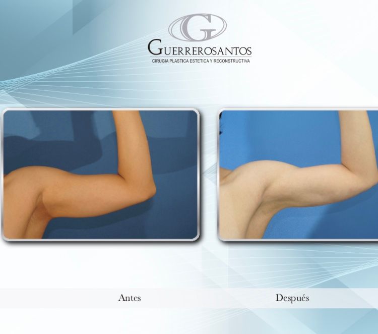 Fernando Guerrerosantos-18