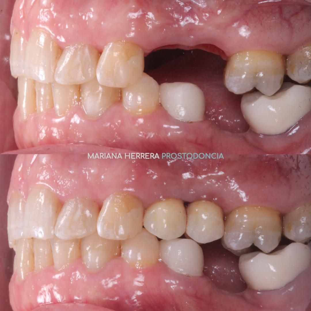 Mariana Herrera Martín Del Campo-20