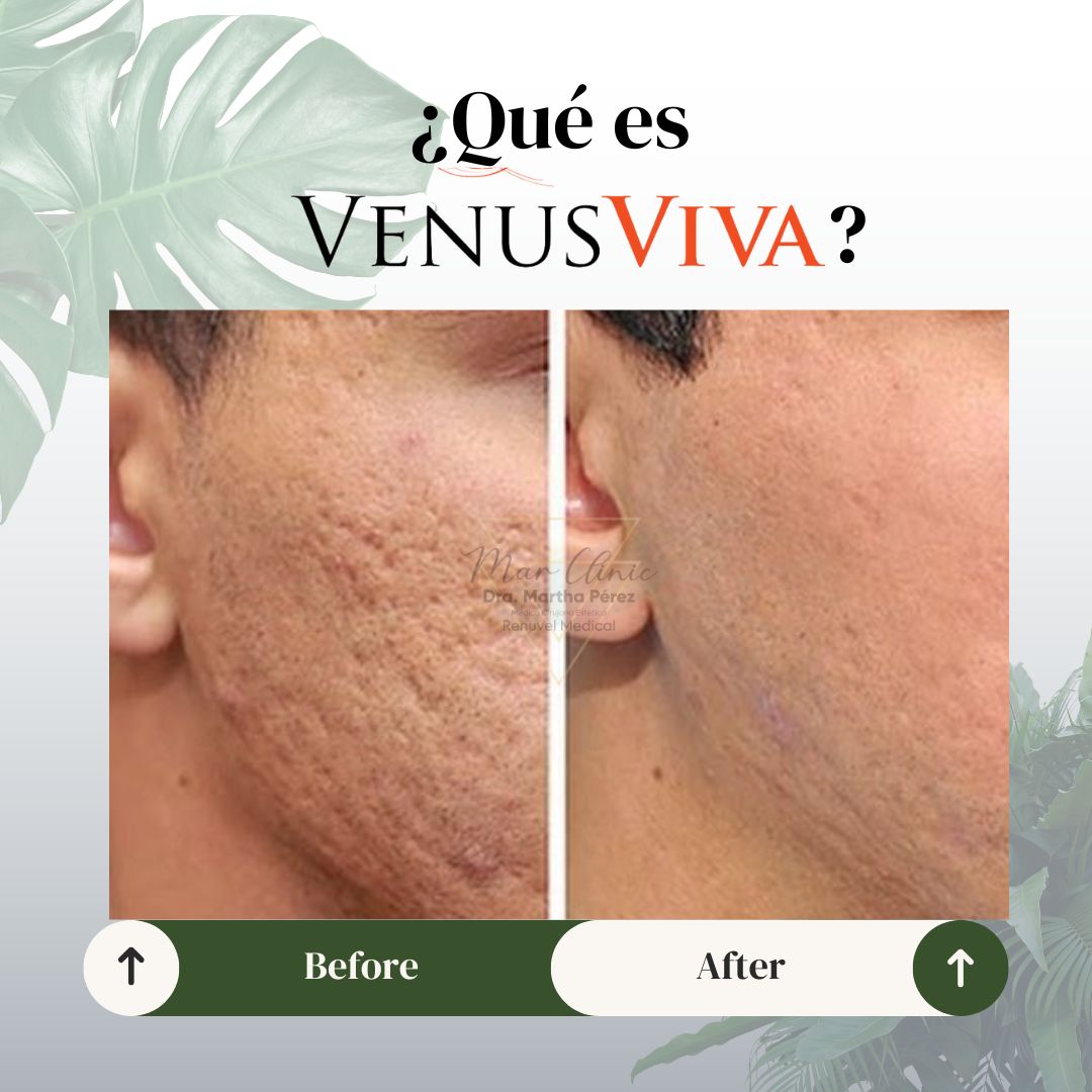 Martha Karina Pérez González-1