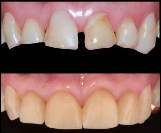 Aide Montserrat Orozco Gutierrez-29