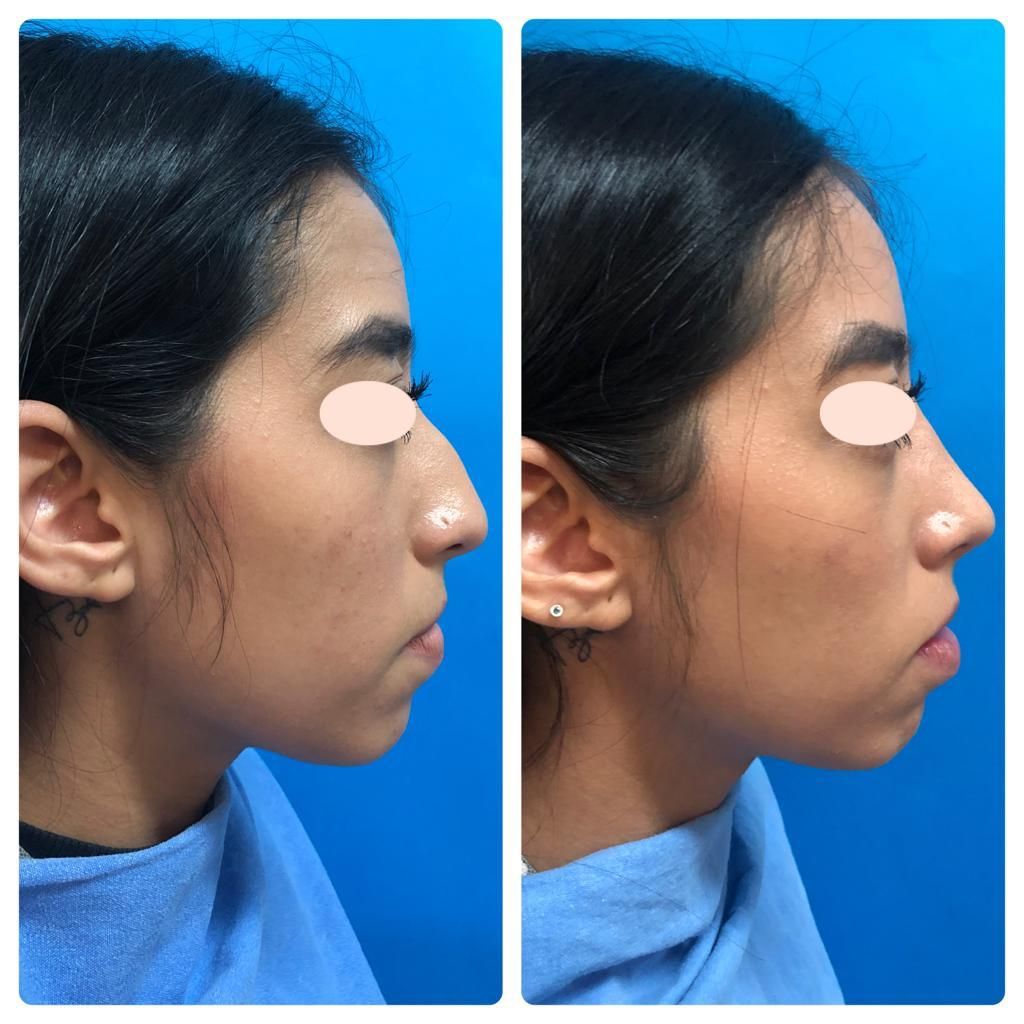 Carola Berenice Curiel Davalos-24