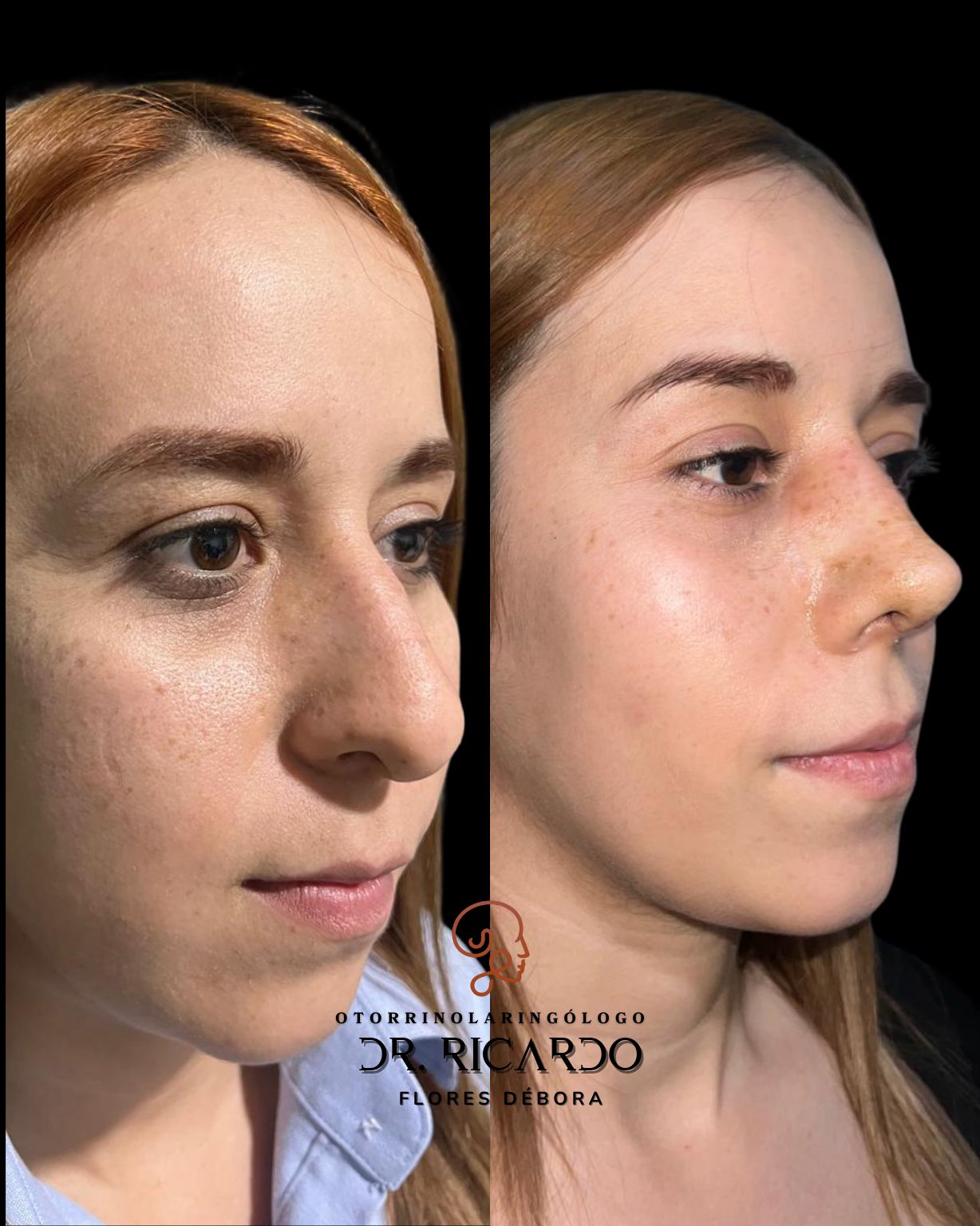 Ricardo Flores Débora-1