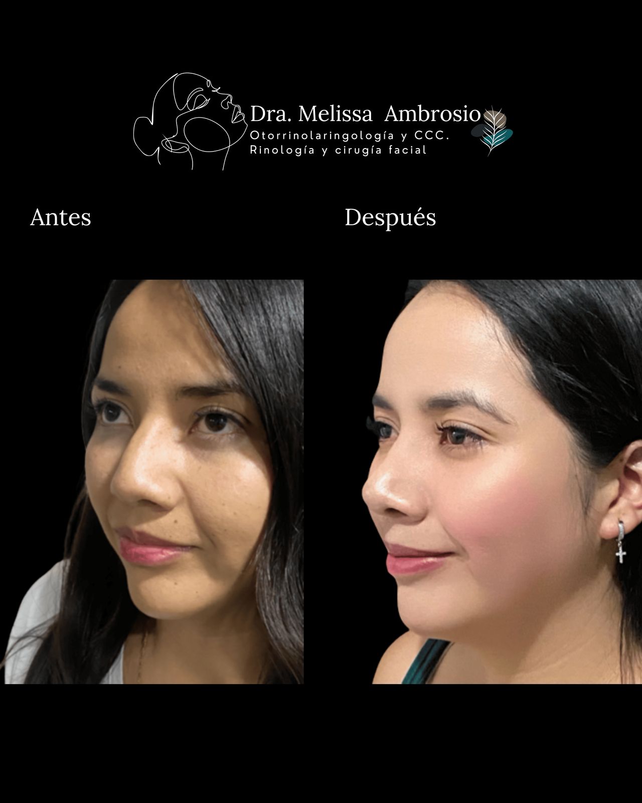 Melissa Guadalupe Ambrosio Mendoza-7