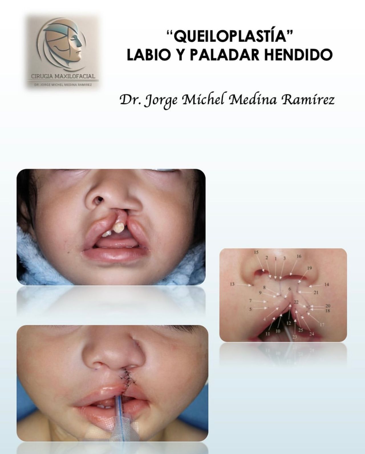 Jorge Michel Medina Ramírez-8