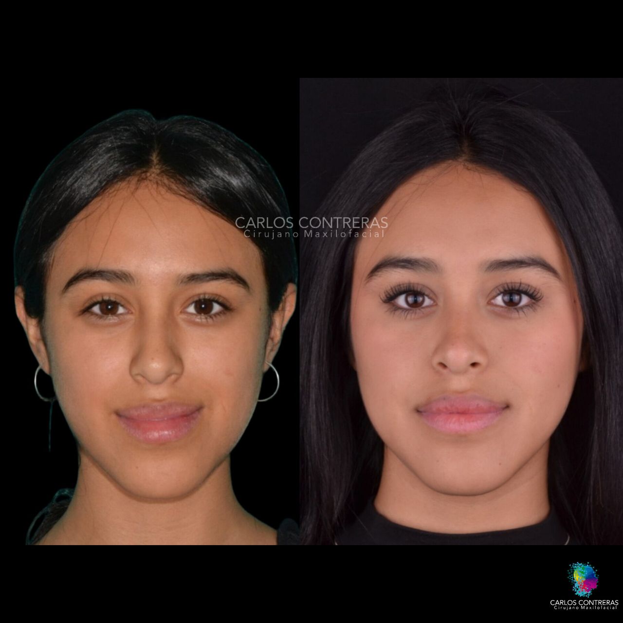 Carlos Ernesto Contreras Castellanos-4