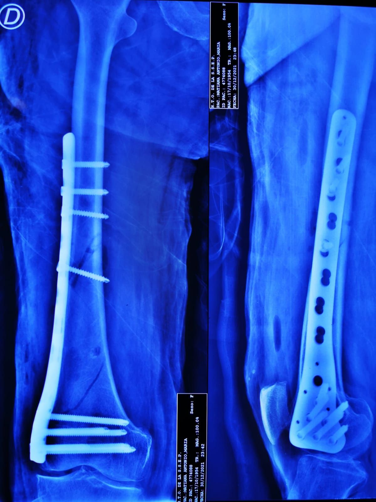 Jair Alejandro Valenzuela Torrano-2