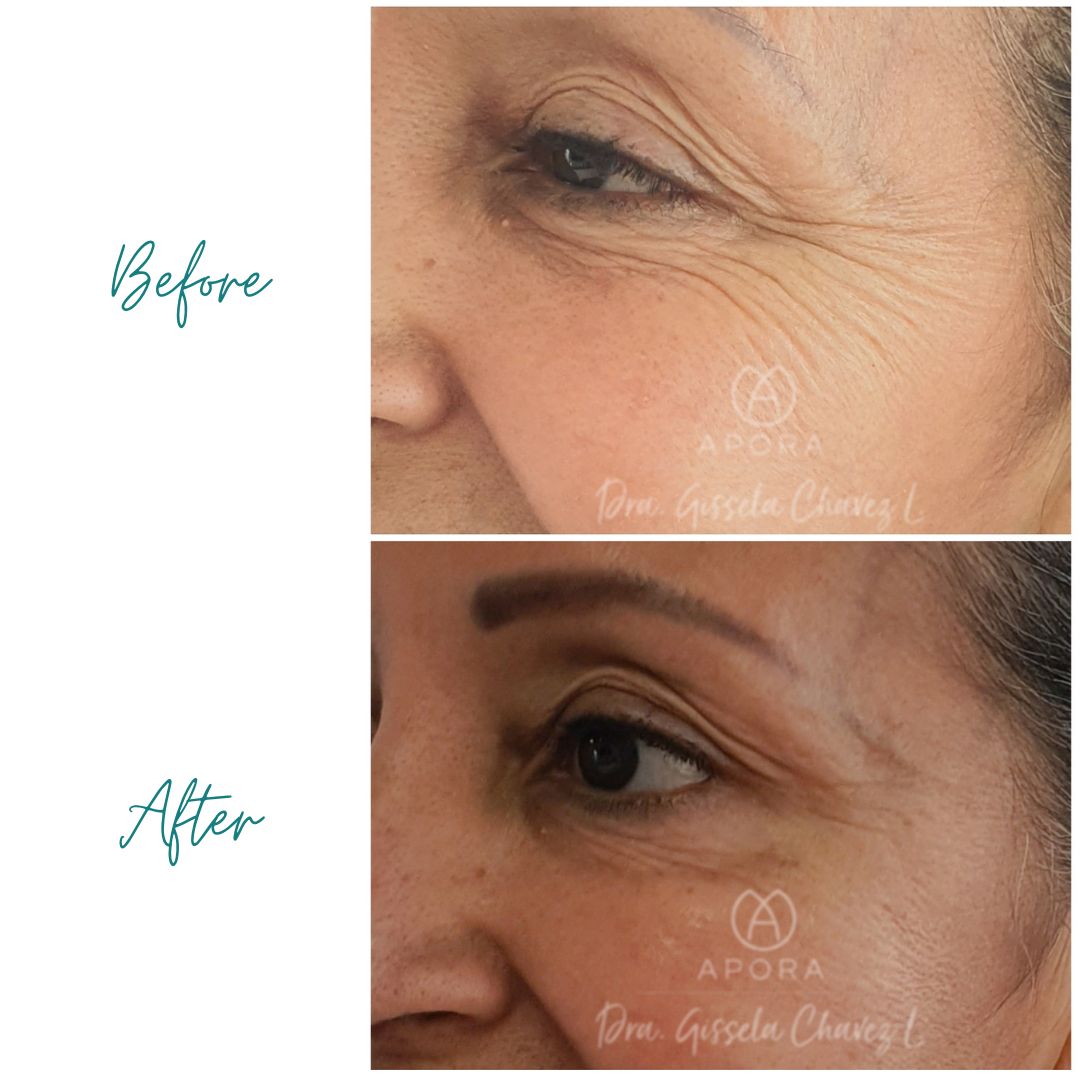 Gissela Chávez Lizardi-21