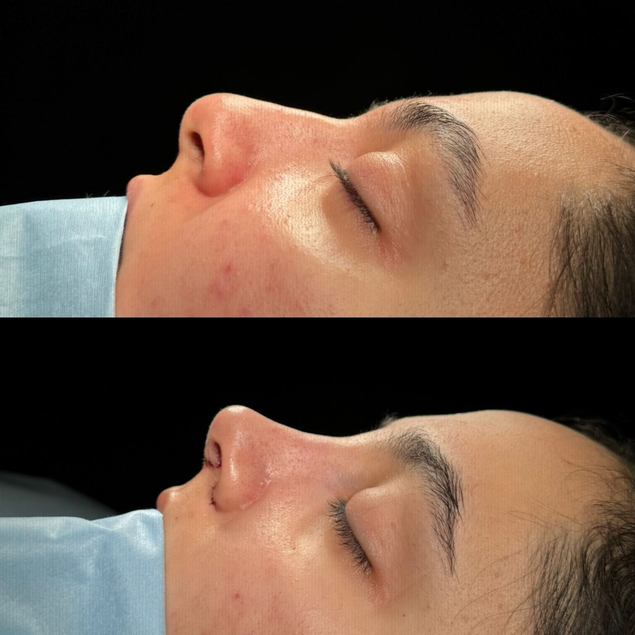 Angel Castro Urquizo-151