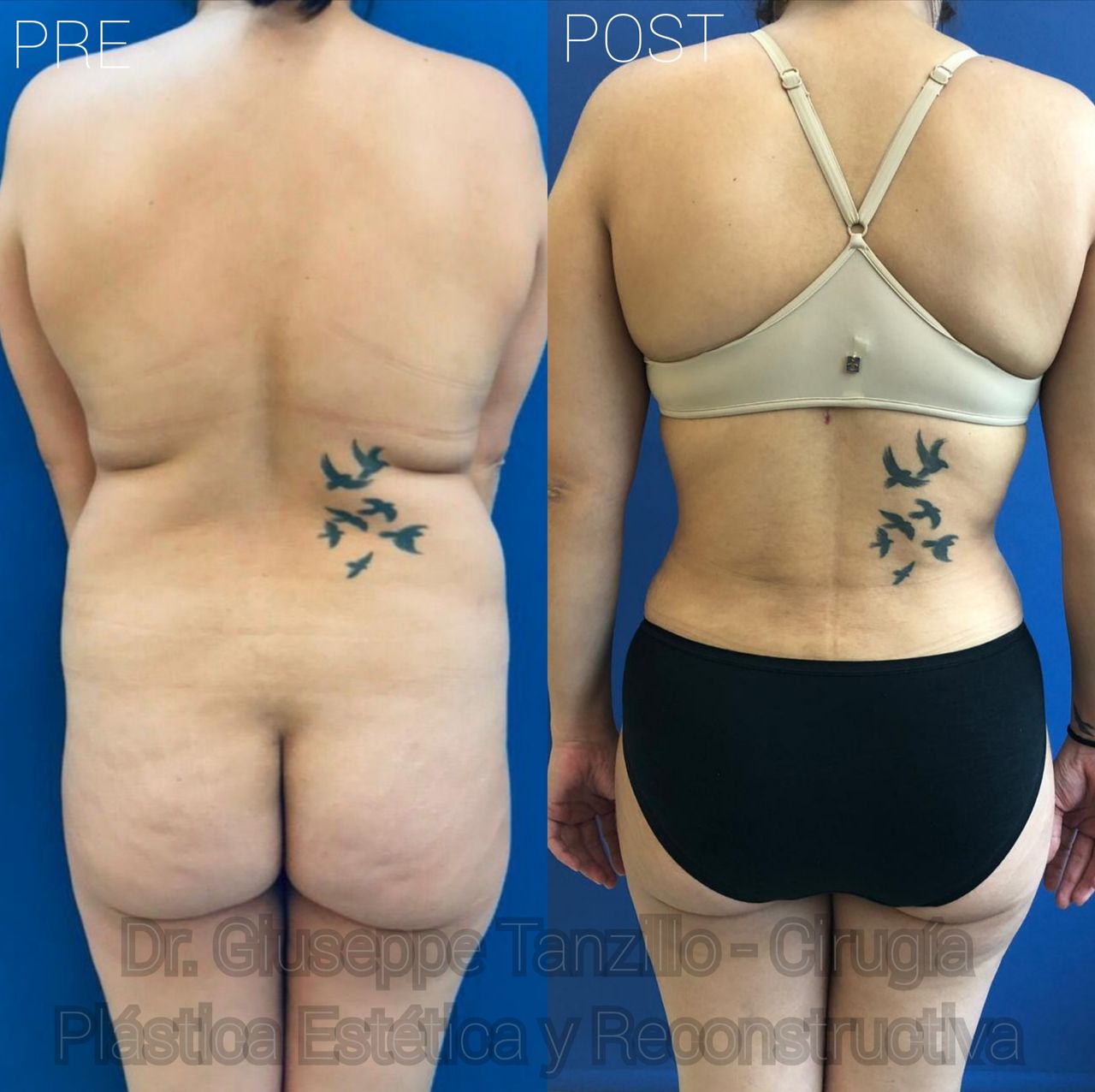 Giuseppe Tanzillo-39