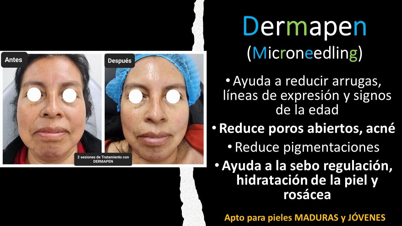 José Luis Muñoz Chapul-10