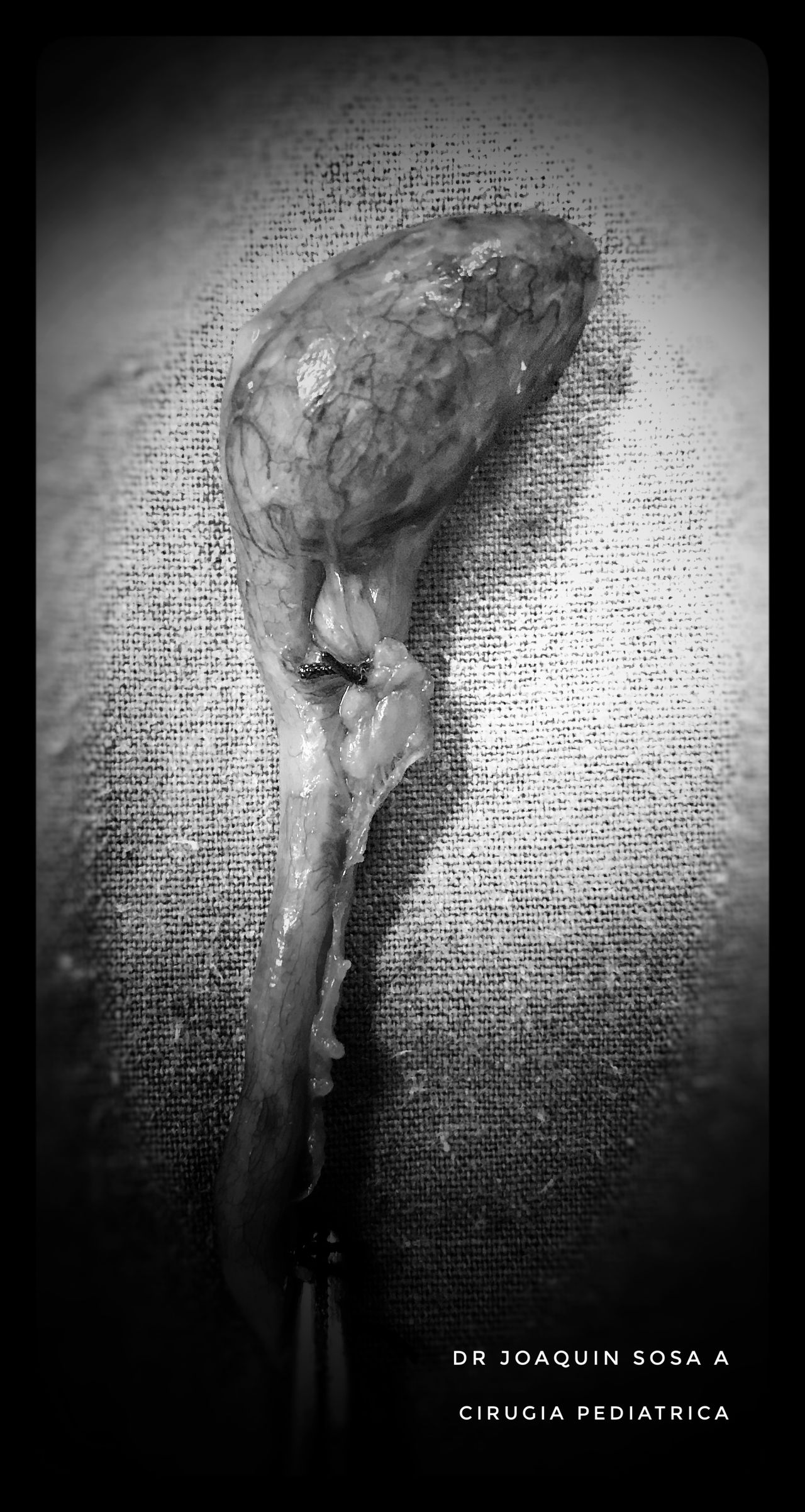 R. Joaquín Sosa Azcorra-32